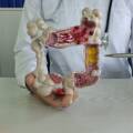 Surgery in Treating Digestive System Diseases